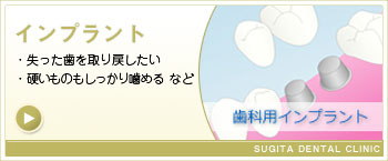 インプラント